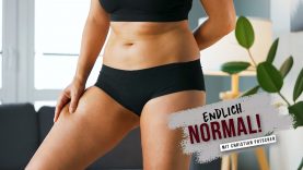 Endlich normal Östrogen-Effekt