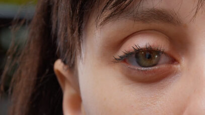 Dr. Mayr Tränensäcke