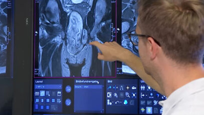 Klinikum Wels Krebsmedizin