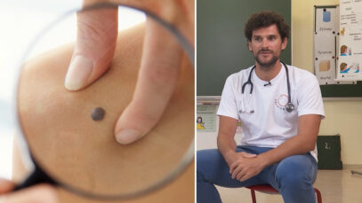 Dr Klartext Muttermale